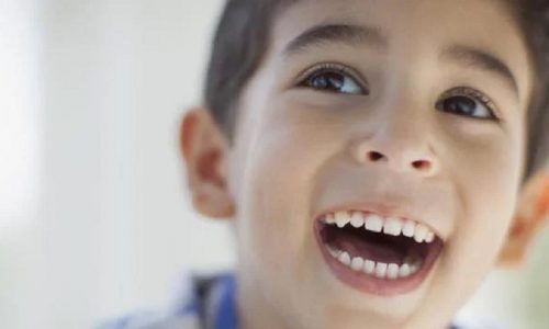 少年兒童牙齒矯正系列產品之齒矯的正常見問題